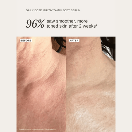 Alpha-H Daily Dose Multivitamin Body Serum 150ml