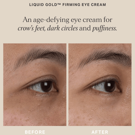 Alpha-H Liquid Gold Firming Eye Cream 15ml