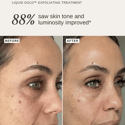 Alpha-H Liquid Gold To-Go 30ml