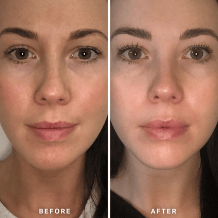 Alpha-H Vitamin B Serum with 5% Niacinamide 10ml