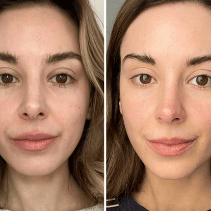 Alpha-H Vitamin C Serum with 10% Ethyl Ascorbic Acid 25ml