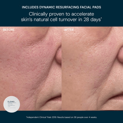 ELEMIS  Glow Bright Resurfacing Trio