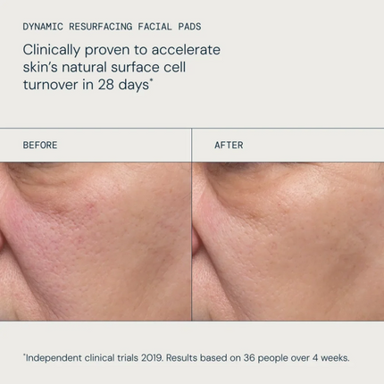 Elemis Resurface & Glow Duo Gift Set