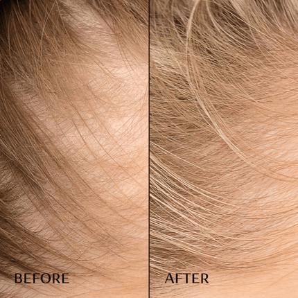 M2 Beaute  Hair Activating Serum 30ml
